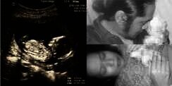 Buah Hati Berpulang, Dea Mirella Tak Kuat Dengar Tangisan Bayi