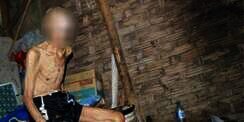 Penderitaan Kakek Pengidap Kanker Kulit Diusir Keluarga