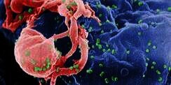 Ilmuwan Sudah Temukan Obat HIV/AIDS?