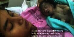 Bayi Sulit Dilahirkan, Setelah Bertemu Ustaz Ternyata...