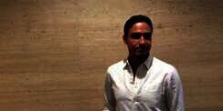 Hamish Daud Pernah Koma 3 Hari, Wajah Penuh Baut