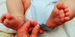 Waspada Jika Urine Bayi Lebih Berbau dari Biasanya