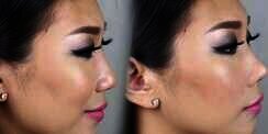Alat Pemancung Hidung `Murah-Meriah` Ini Efektif, Tapi....