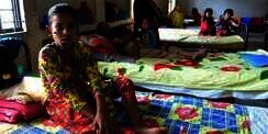 Idap Sindrom Aneh, Wajah Bocah Gadis Ditumbuhi 'Kayu'