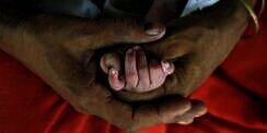 Kasihan, Bayi Umur 1 Tahun Alami Pubertas Lebih Cepat