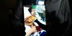 Jupe Kembali Jalani Operasi