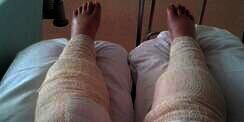 Wanita Ini Salah Cukur Bulu Kaki, Akibatnya Mengerikan