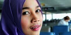 Inilah Alasan Orang Memakai Kawat Gigi