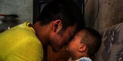Bikin Nangis! Pengorbanan Kakak Demi Adik Pengidap Leukemia