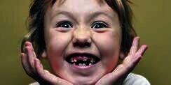 Akibat Gigi Susu Anak Rusak