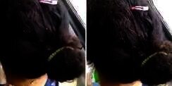 `Peternakan` Kutu di Rambut Wanita Ini Bikin Merinding