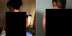 Sebar Foto Kerokan, Wanita Ini Bikin Heboh