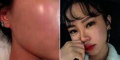 Rahasia Dapatkan Wajah 'Glass Skin' ala Cewek Korea