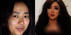 `Before-After` Wajah Soimah, Percaya?
