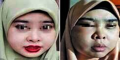 Tergiur Krim Pemutih, Wajah Perempuan Ini Berakhir Bengkak