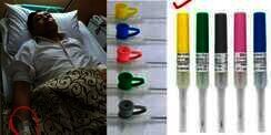 Jarum Infus Setnov Disorot, Ada yang Aneh?