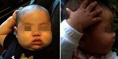 Bayi Lucu Ini Sering Sentuh Kepala Tanpa Alasan, Ternyata..