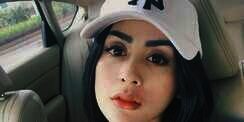 Bikin Geger! Wajah Penyanyi Ini Penuh Jarum