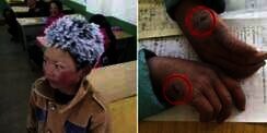 Sampai Sekolah Rambut Memutih, Haru Lihat Perjuangan Bocah Ini