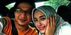 Ada Perbedaan di Wajah, Istri Pasha 'Ungu' Lakukan Oplas?