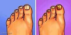Lima Tanda di Area Kaki Ini Tunjukan Kondisi Kesehatan Kamu