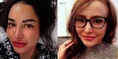 Begini Penampilan Cynthiara Alona Saat Filler Bibirnya Memudar