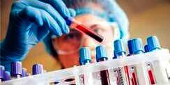 Sterilisasi Alat Medis Bermasalah, 3.778 Pasien Diminta Tes HIV