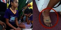 Pakai Sepatu 'Nike' dari Perban, Gadis Ini Menangkan 3 Medali Emas