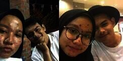 Viral! Pesan Menyentuh Pemuda tentang Pacarnya yang Jerawatan Parah