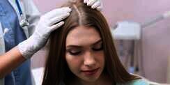 Mengenal Jenis Perawatan Rambut Rontok di Klinik Kecantikan