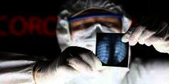 Begini Kondisi Tubuh Pasien yang Sembuh dari Virus Corona Covid-19