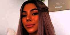 YouTuber Yulia Baltschun Pamer Foto Sebelum Oplas, Lihat Perubahannya