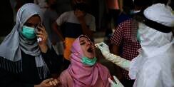 Paru-paru Pasien Covid-19 Sembuh Dapat Pulih Sepenuhnya