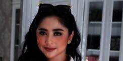Positf Covid-19, Wajah dan Sekujur Tubuh Dewi Perssik Penuh Bercak Merah