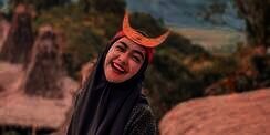 Dagu Berubah Jadi Lancip Banget, Ria Ricis Operasi Plastik?