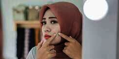 Kenali 4 Tahap Pertumbuhan Jerawat