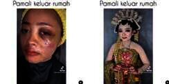 Cerita MUA Dandani Wajah Pengantin Penuh Luka Kecelakaan, Hasilnya Bikin Takjub