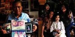 Kabar Bayi Kembar Siam Yuliana-Yuliani, Kini Jadi Orang Hebat