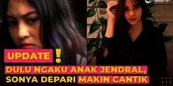 Dulu Ngaku Anak Jenderal, Sonya Depari Makin Cantik