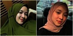 Sempat Jerawatan, Ini 8 Potret Nissa Sabyan dengan Wajah Mulus Tampil Polos