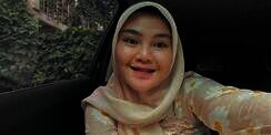 Ingat Rosa Meldianti, Keponakan Dewi Perssik? Dulu Dibully, Kini Penampilannya Beda Banget!
