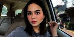 Potret Laura Anna Menangis dalam Tidurnya Usai Kecelakaan
