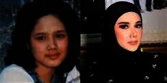 10 Potret Artis Sebelum VS Sesudah Mengenal Perawatan, Cita Citata Beda Banget!