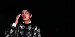 Atta Halilintar Transplantasi Rambut, Good Bye Headband!