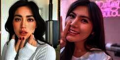 6 Artis Cantik yang Pernah Gagal Oplas, Jessica Iskandar Sampai `Alergi` Matahari!