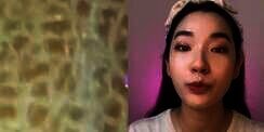 Kulit Bertekstur Seperti Sisik Ikan, Ini Penyebabnya