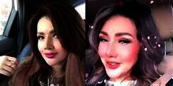 10 Potret Terbaru Barbie Kumalasari Usai Operasi Hidung Rp50 Juta, Berubah Drastis Makin Cantik!