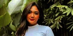 Potret Terbaru Marion Jola dengan Bentuk Pipi Berubah Lebih Tirus