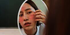 Tidak Dapat Disembuhkan, Dermatitis Atopik Bisa Dikendalikan Dengan 3 Cara Ini