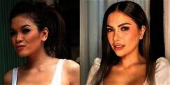 9 Potret Artis Sebelum VS Sesudah Oplas Hidung, Seleb Terakhir Disebut Aneh & Banjir Hujatan!